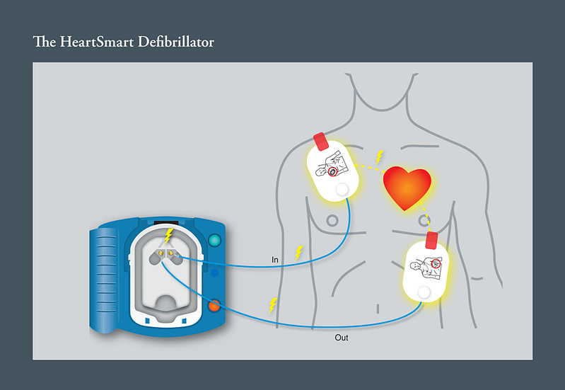 defribillator1